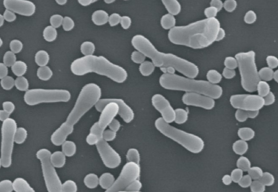 图 1. 乳双歧杆菌 B-420（©杜邦）的扫描电子显微照片。.png